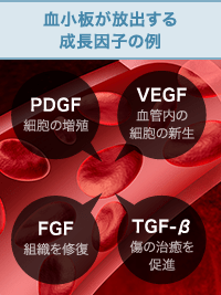 血小板が放出する成長因子の例