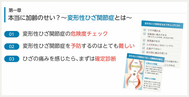 電子書籍「変形性膝関節症には最新治療がある」第一章の内容紹介