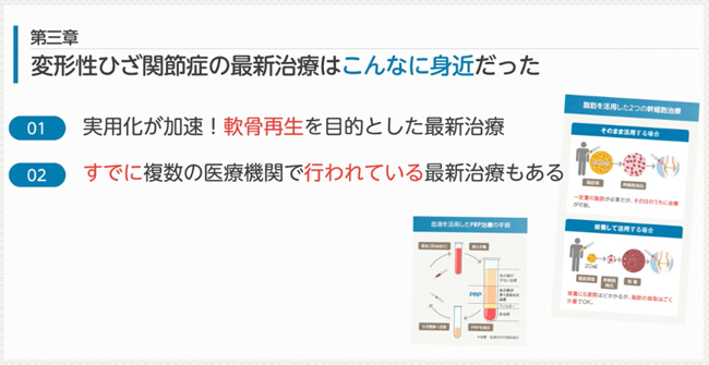 電子書籍「変形性膝関節症には最新治療がある」第三章の内容紹介